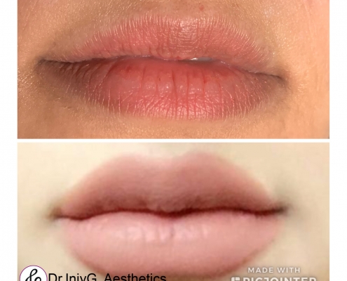 Angelina’s Lips